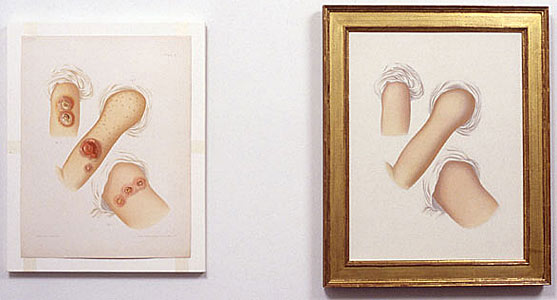 DAVID MORENO: Untitled (Plate IX), 1993 dmf9303